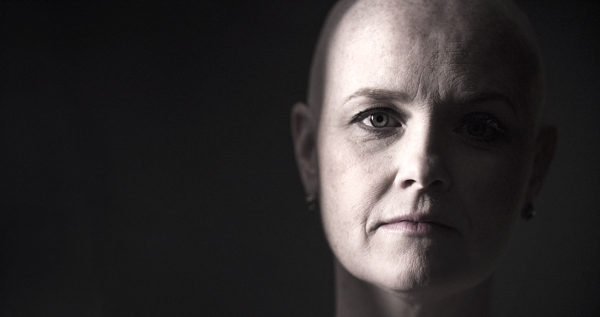 Healthcare Photographer, Healthcare images, Cancer survivor photoshoot, Cancer survivor photography